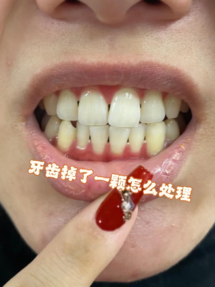 孕妇梦到掉牙齿是什么预兆