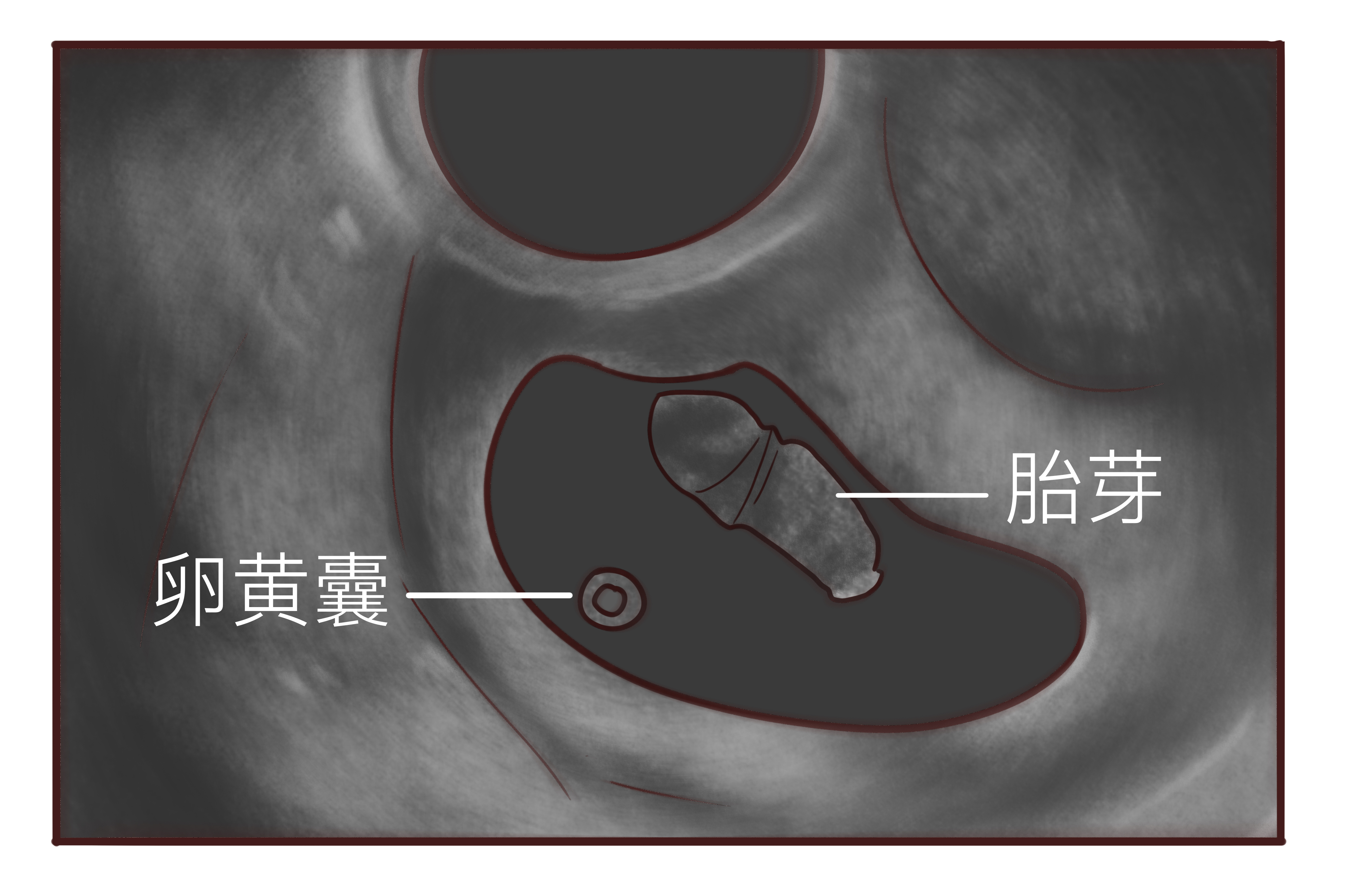 母胎solo是什么意思