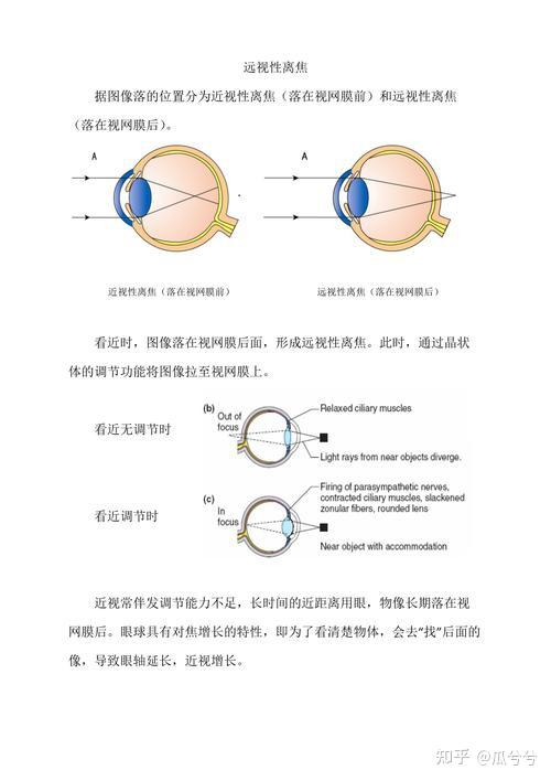 150度近视是几点几
