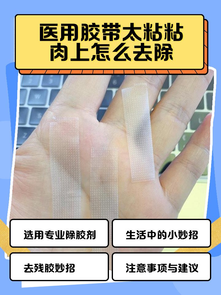 胶布残留的胶怎么样去除